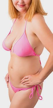 Gastric Sleeve - Before & After Images Gastric Sleeve - Before & After Images